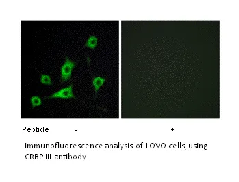 CRBP III Antibody - image 1