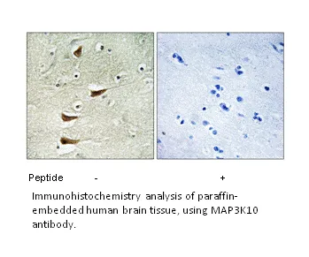 MAP3K10 Antibody - image 1