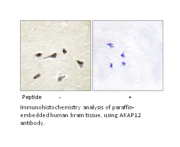 AKAP12 Antibody - image 1