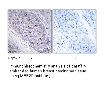 MEF2C Antibody - image 1