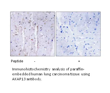 AKAP13 Antibody - image 2