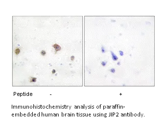 JIP2 Antibody - image 2