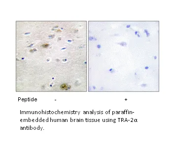 TRA-2α Antibody - image 3