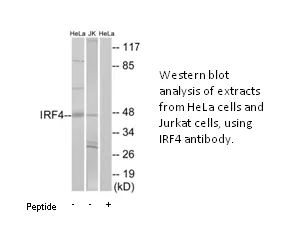 IRF4 Antibody - image 1