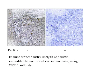 ZMY11 Antibody - image 1