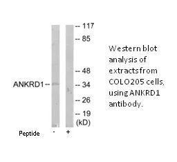 ANKRD1 Antibody - image 1