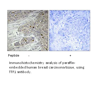 TTF1 Antibody - image 1