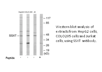 SSXT Antibody - image 1