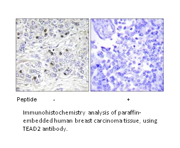 TEAD2 Antibody - image 2