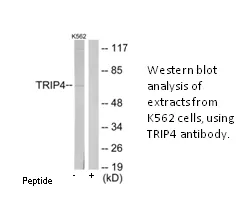 TRIP4 Antibody - image 1