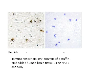 NAB2 Antibody - image 1