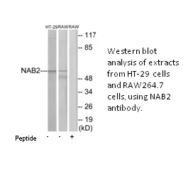 NAB2 Antibody - image 2
