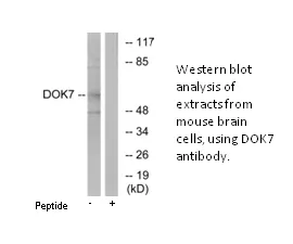 DOK7 Antibody - image 2