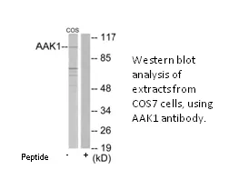 AAK1 Antibody - image 1