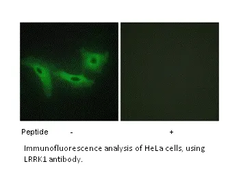 LRRK1 Antibody - image 1