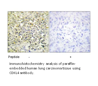 CDKL4 Antibody - image 2