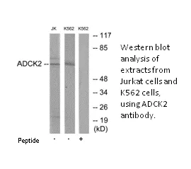 ADCK2 Antibody - image 1