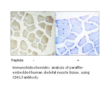 CDKL3 Antibody - image 1