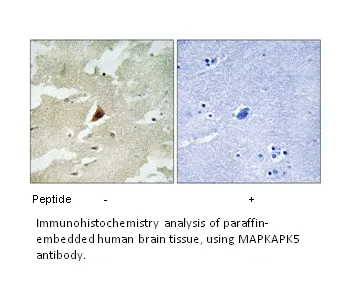 MAPKAPK5 Antibody - image 1