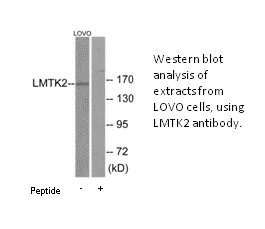LMTK2 Antibody - image 2