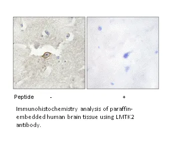 LMTK2 Antibody - image 3