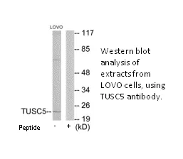TUSC5 Antibody - image 2