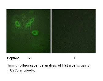 TUSC5 Antibody - image 1