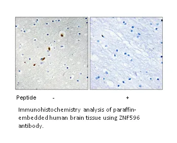ZNF596 Antibody - image 1