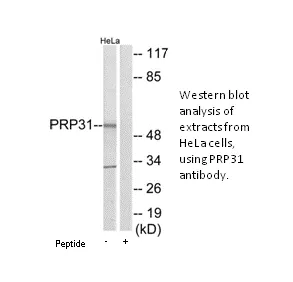 PRP31 Antibody - image 1