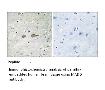 MADD Antibody - image 3