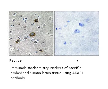 AKAP1 Antibody - image 1