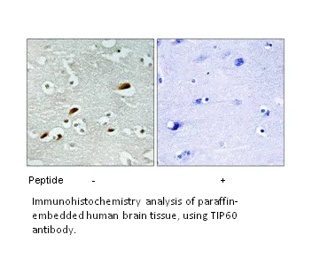 TIP60 Antibody - image 1