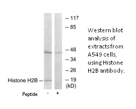 Histone H2B Antibody - image 2