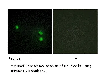 Histone H2B Antibody - image 1