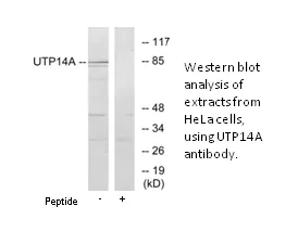 UTP14A Antibody - image 1