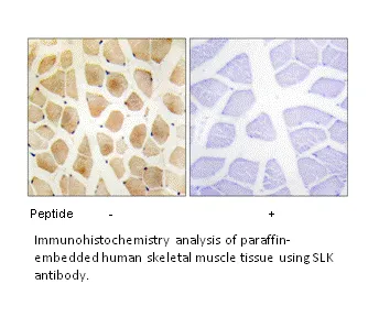 SLK Antibody - image 2