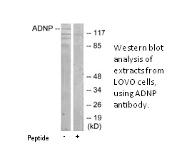ADNP Antibody - image 1