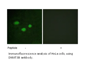 DNMT3B Antibody - image 1