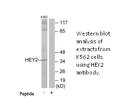 HEY2 Antibody - image 1