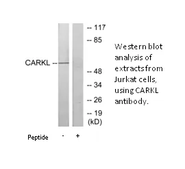 CARKL Antibody - image 1