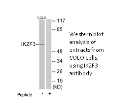 IKZF3 Antibody - image 1