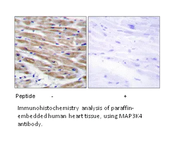 MAP3K4 Antibody - image 1