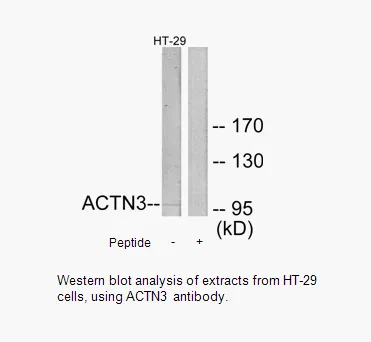 ACTN3 Antibody - image 1