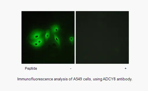 ADCY8 Antibody - image 1