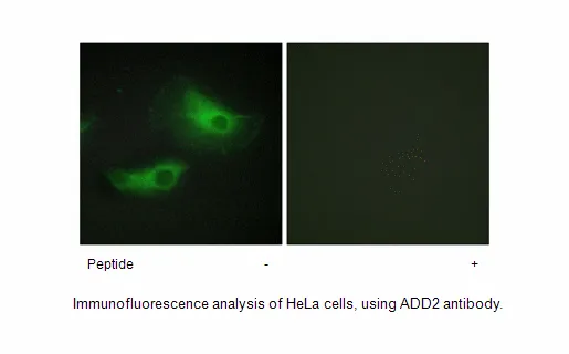 ADD2 Antibody - image 2
