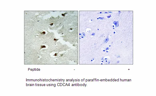 CDCA4 Antibody - image 1