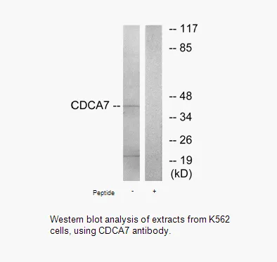 CDCA7 Antibody - image 1