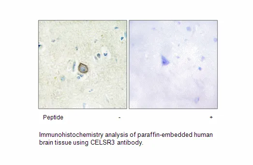 CELSR3 Antibody - image 2