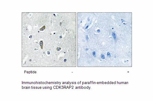 CDK5RAP2 Antibody - image 1