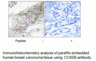 COX5B Antibody - image 1